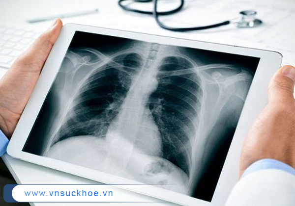 Chụp X-quang là bước quan trọng trong quá trình khám nội khoa